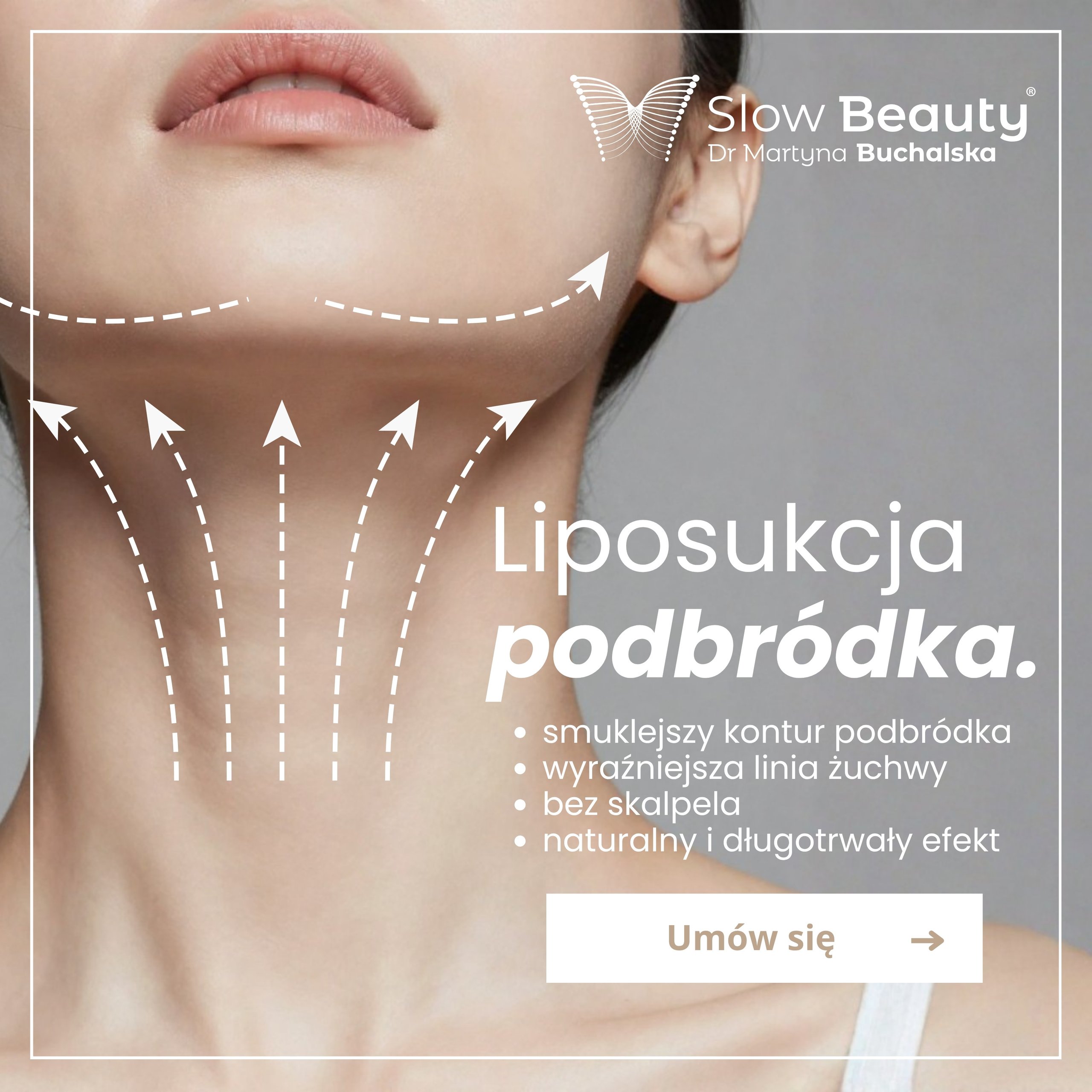 Promotional graphic showing a close-up jawline with arrows and Polish text about chin liposuction.