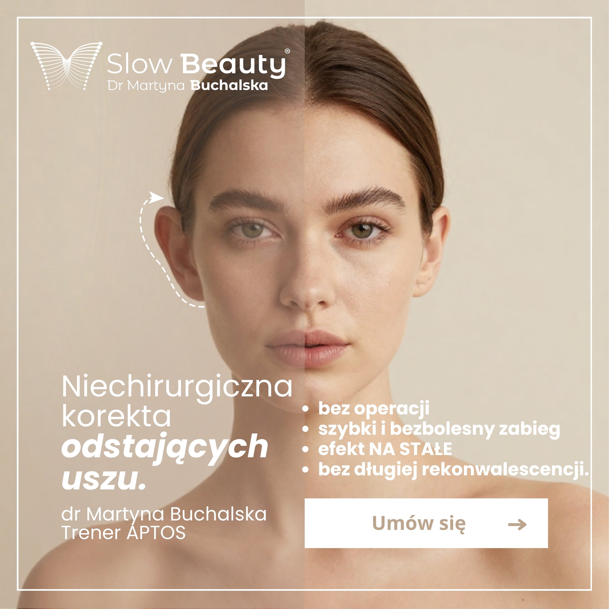 Beige promotional graphic showing a split before-and-after portrait and text about nonsurgical protruding-ear correction.